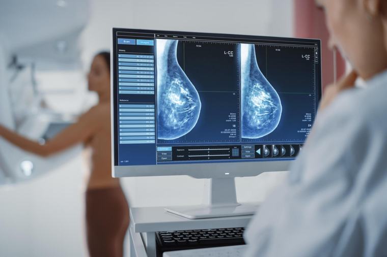 Mammografie kann auch Herz-Kreislauf-Erkrankungen erkennen